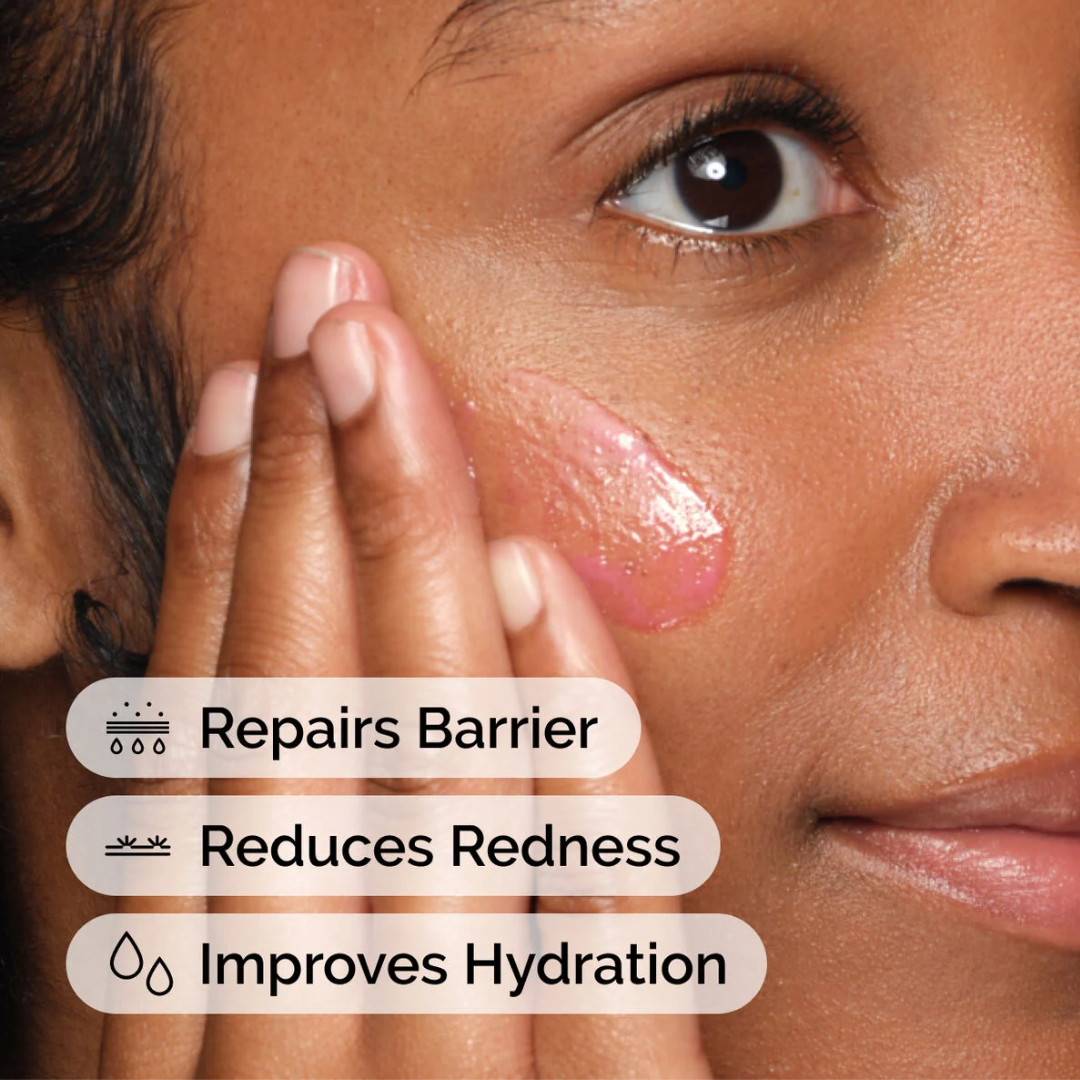 The Ordinary Soothing & Barrier Support Serum