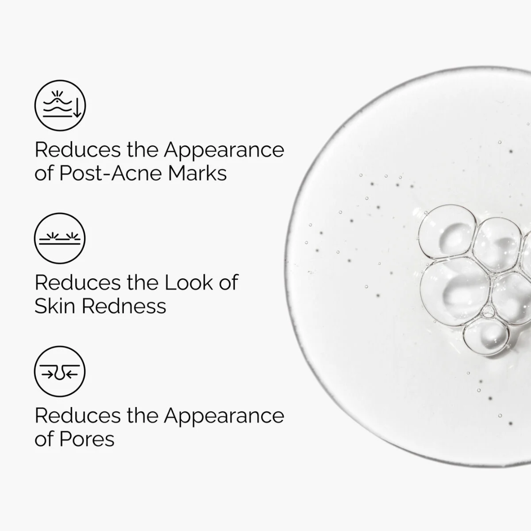 The Ordinary Aloe 2% + NAG 2% Solution 30ml